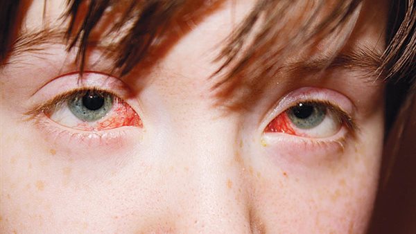 صورة تعبيرية