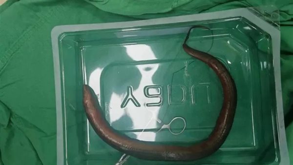 ثعبان البحر