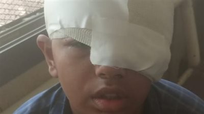 صغير يتنمر على زميله ويصيبه في الوجه بأبو النمرس.. ووالده: ابني فضل في العمليات 5 ساعات| صور
