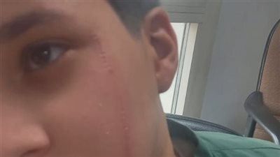 اليوم.. نظر جلسة استئناف والد المتهم بالتعدي على زميله أمام مدرسة بالبدرشين