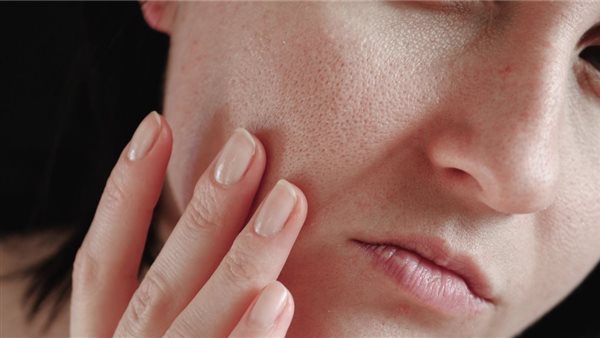 إزاي تعرف نوع بشرتك