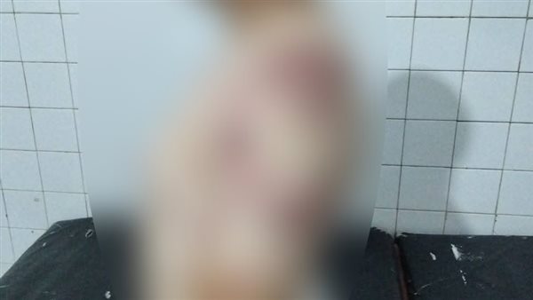 المجني عليه مصطفى