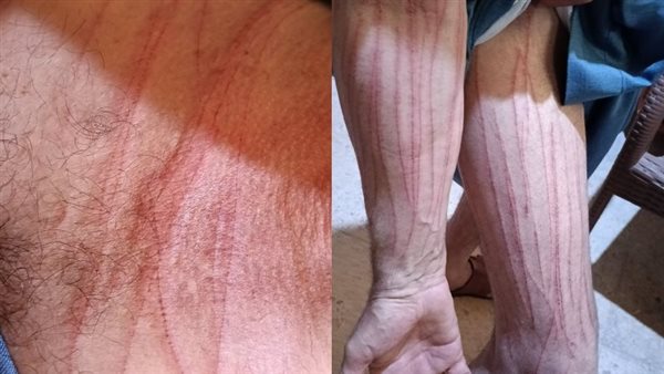  صورة تعبيرية 