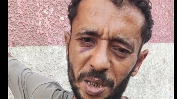 علاء أحد مصابي حادث