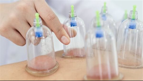 فوائد الحجامة الصحية