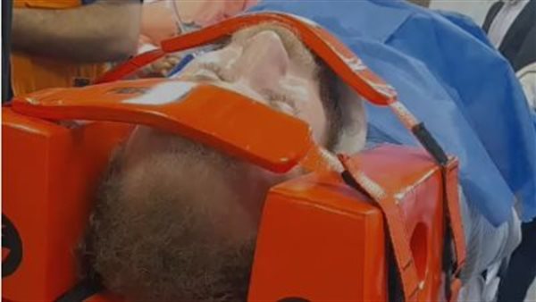 إصابة مصور خلال جولة