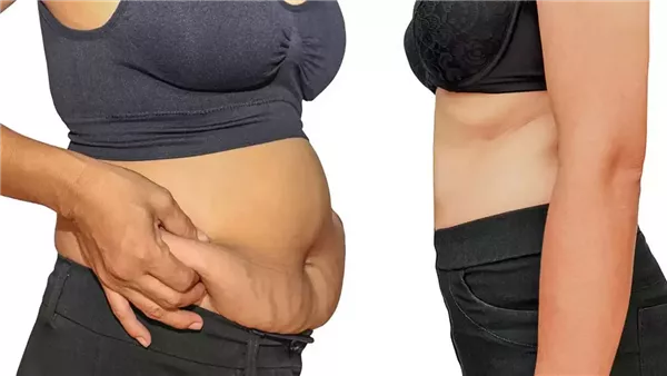 كيفية التخلص من الكرش