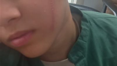 31 يوليو.. أولى جلسات محاكمة الطالب المتهم بتشويه وجه زميله بسبب الغش في البدرشين