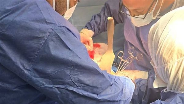 جانب من العملية الجراحية