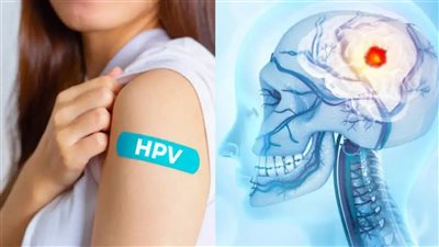 لماذا لم يعد سرطان الرأس والرقبة مرضًا يقتصر على المدخنين؟.. دراسة توضح الأسباب 