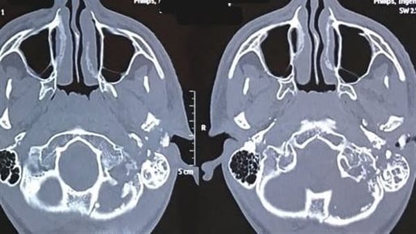 أشعة المريض 