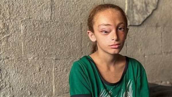 الطفلة سارة 