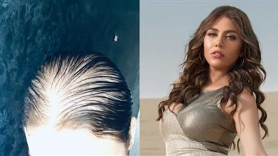 قلبي مكسور.. الفنانة رحمة حسن عن تساقط شعرها: بقاله سنتين بالحالة دي وبعاني من قلق وتوتر دائم