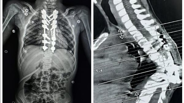 أشعة المريضة