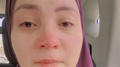 مصدر: الصحة تبحث الحالة الطبية للطفل علي المصاب بضمور عضلات.. ورجال أعمال يدرسون التبرع لتوفير الحقنة