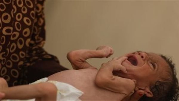 مجاعة غزة - أرشيفية