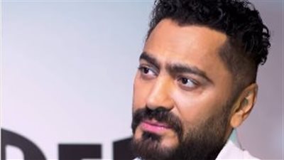 إصابة تامر حسني بكسر في القدم تثير قلق الجمهور.. ما القصة؟