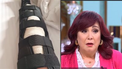 شيرين تكشف تفاصيل إصابتها في الركبة: اتكسرت 7 قطع 