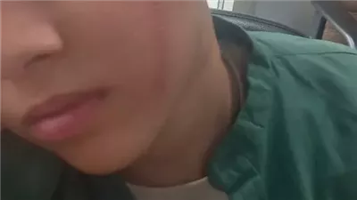 شوّه وجهه لأنه مغششهوش.. إيداع طالب دار رعاية بتهمة التعدي على زميله في البدرشين