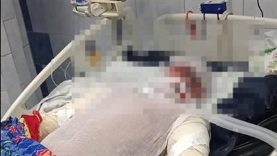 بعد إنقاذه الكثيرين.. أسرة بطل حريق محطة مترو شبرا الخيمة تستغيث لنقله إلى مستشفى أهل مصر