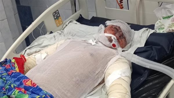 الصبي المصاب أحمد