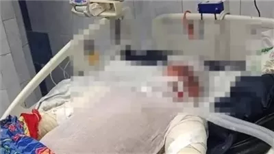 توقف عضلة القلب وحروق لهبية قديمة.. ننشر التقرير الطبي لبطل حريق محطة شبرا الخيمة المتوفى بعد إنقاذ عدة أشخاص