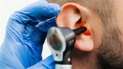 كيفية تنظيف شمع الأذن بأمان دون التعرض لمخاطر صحية.. تعرف على الطريقة
