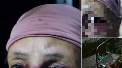 تهديدات لفظية وجسدية.. سيدة تدعي تعرضها للاعتداء على يد زوج شقيقتها: بيضرب أمي في بيتها