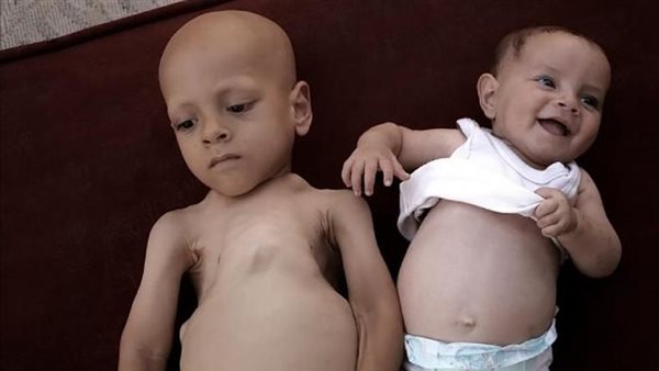 حبيبة وشقيقها 