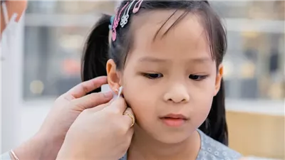 خبراء يحذرون: ثقب آذان الأطفال قد يرفع خطر الإصابة بحساسية مزمنة من النيكل