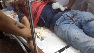 أصابه بـ 200 غرزة..شاب يعتدي على شقيقه بسبب الميراث في قرية الشعراء بدمياط