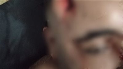 بسبب كلب بلدي.. اعتداء بالأسلحة البيضاء على عائلة بالقاهرة