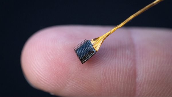 شريحة الدماغ 