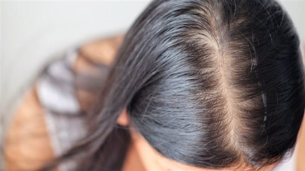 أفضل فيتامينات لتساقط