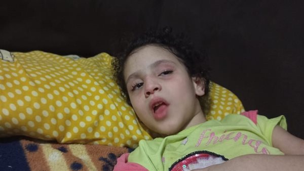 الطفلة المصابة بمرض