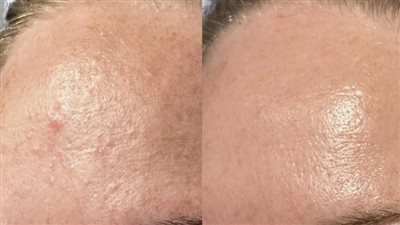 امرأة تلجأ إلى ChatGPT لوضع روتين مخصص للعناية بالبشرة وتُحقق نتائج مذهلة