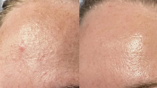 روتين البشرة 