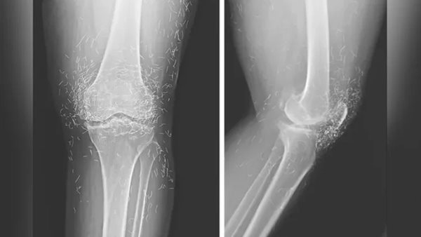 صورة الأشعة