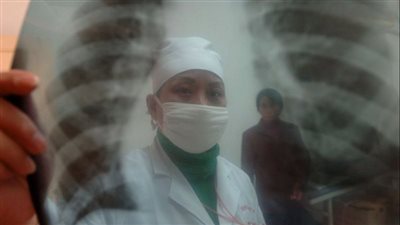 دراسة: 3 مشكلات صحية مرتبطة بزيادة خطر الوفاة بمرض الكبد الدهني