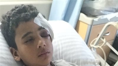 طفل يتعرض لإصابة بالغة خلال استقلاله قطارا بالمنوفية.. ووالده: عايز حقه