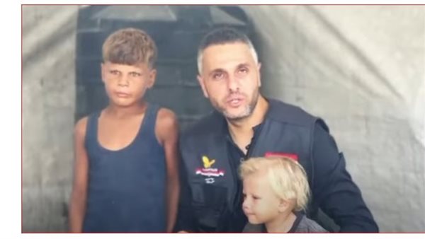 الطفل جدوع وشقيقه