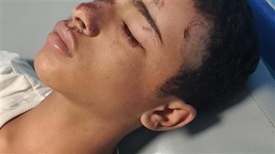 أول تعليق من منطقة سوهاج الأزهرية بشأن واقعة اعتداء معلم على طالب بمعهد بنين طما