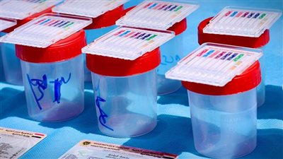 مكافحة الإدمان: 8433 موظفا بالجهاز الإداري للدولة خضع للكشف عن تعاطي المخدرات في أسبوع