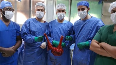 فريق الجراحة بمستشفى الفيوم العام يستأصل ورمًا بالقولون يزن 7 كيلو جرامات