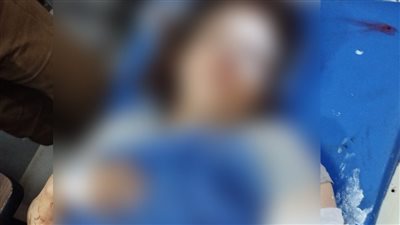 بسبب قضية نفقة وطلب الطلاق.. زوج يصيب زوجته بـ30 غرزة بعد اعتدائه عليها بكتر في المحلة