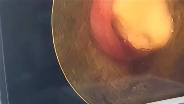 جانب من حالة