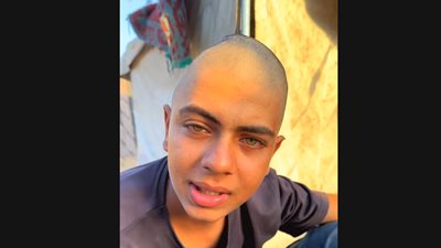 شاب فلسطيني يستغيث: إيدي الشمال مشلولة.. ونفسي حد يوفرلي المسكنات لغاية ما أعمل العملية