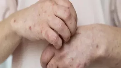 أسباب ظهور بقع حمراء في الجسم.. حساسية أو إجهاد