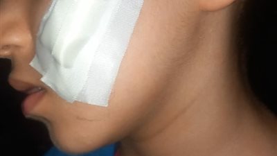 التحقيق مع طالب أصاب زميله بعاهة مستديمة في مدرسة بحلوان