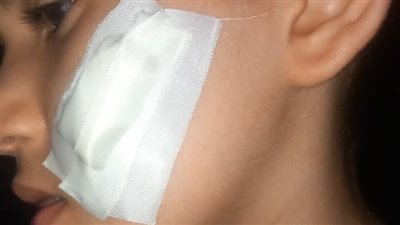 جرحه بكتر.. التحقيق مع طالب بالصف الثالث الابتدائي اعتدى على زميله داخل فصل مدرسة في حلوان